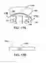 Fig. 17 - Method of assembling an electrode array that includes a plastically deformable carrier