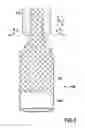 Fig. 04 - Delivery System for an Implantable Medical Device