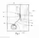 Fig. 02 - FLEX SAFE SUTURE SLEEVE