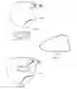 Fig. 20 - GOLF CLUB HEAD WITH STABILIZING SOLE