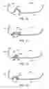 Fig. 17 - Golf club head with flexure
