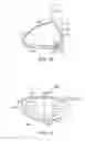 Fig. 20 - Golf club head with flexure