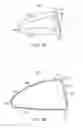 Fig. 21 - Golf club head with flexure