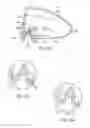 Fig. 25 - Golf club head with flexure