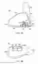 Fig. 26 - Golf club head with flexure