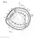 Fig. 11 - BASEBALL OR SOFTBALL GLOVE