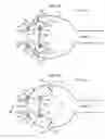 Fig. 06 - Device for controlling the charge of an aerosol post-discharge