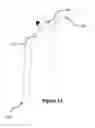 Fig. 12 - Personal rechargeable portable ionic air purifier