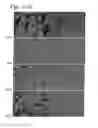 Fig. 20 - Device with electrospray coating to deliver active ingredients