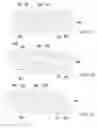 Fig. 06 - Device and method for removing impurities from shredded plastic