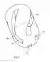 Fig. 04 - Submerged entry nozzle