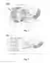 Fig. 02 - Bendable, telescopic, and flexible continuum mechanical structure
