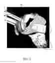 Fig. 05 - Protective weapon