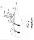 Fig. 03 - Cutting unit with guard teeth and hair-cutting device