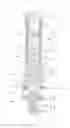 Fig. 11 - Injection compression apparatus for manufacturing thermoplastic containers