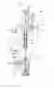 Fig. 09 - Injection mold of a plastic preform