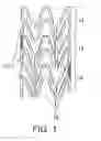Fig. 02 - Multilayer bioabsorbable scaffolds and methods of fabricating