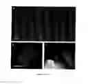 Fig. 10 - HIGH-THROUGHPUT MANUFACTURING OF MICRONEEDLES