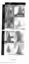 Fig. 16 - HIGH-THROUGHPUT MANUFACTURING OF MICRONEEDLES