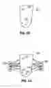 Fig. 08 - System and method for making sockets for prosthetic limbs