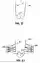 Fig. 09 - System and method for making sockets for prosthetic limbs