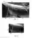 Fig. 03 - GRAFFITI COVERING SKIN