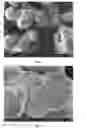 Fig. 03 - RUTILE TITANIUM DIOXIDE MICROSPHERES AND ORDERED BOTRYOIDAL SHAPES OF SAME