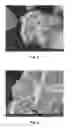 Fig. 04 - RUTILE TITANIUM DIOXIDE MICROSPHERES AND ORDERED BOTRYOIDAL SHAPES OF SAME