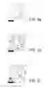 Fig. 05 - Method for producing an Al/TiC nanocomposite material