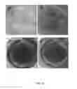 Fig. 19 - Methods and compositions for treatment of cyanide and hydrogen sulfide toxicity