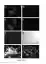 Fig. 05 - Endometriosis cell targeting peptide and uses thereof