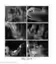Fig. 07 - Endometriosis cell targeting peptide and uses thereof
