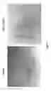 Fig. 02 - Nucleic acids encoding peptides for treating wounds, anti-angiogenic compounds and uses thereof