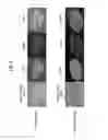 Fig. 05 - METHOD OF SUBCULTURING PLURIPOTENT STEM CELLS