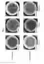 Fig. 09 - METHOD OF SUBCULTURING PLURIPOTENT STEM CELLS
