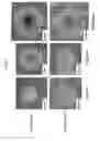 Fig. 10 - METHOD OF SUBCULTURING PLURIPOTENT STEM CELLS