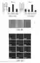 Fig. 14 - Compositions and Methods for Autologous Germline Mitochondrial Energy Transfer