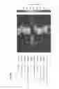 Fig. 18 - Method for Identifying RNA Segments Bound by RNA-Binding Proteins or Ribonucleoprotein Complexes