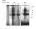 Fig. 27 - Method for Identifying RNA Segments Bound by RNA-Binding Proteins or Ribonucleoprotein Complexes