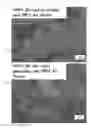 Fig. 14 - METAL COMPOSITE COMPRISING ALIGNED PRECIPITATE AND PREPARATION METHOD THEREFOR