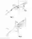 Fig. 03 - Balancing screw, device and method for a rotating part of a turbine engine