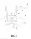 Fig. 04 - Distributed spark igniter for a combustor