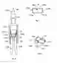 Fig. 04 - Mechanical bypass light unit