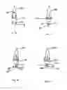 Fig. 11 - Mechanical bypass light unit