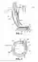 Fig. 03 - Variable swirl fuel nozzle