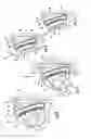 Fig. 03 - Air conditioner with selective filtering for air purification