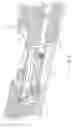 Fig. 08 - ELASTIC PROJECTILE PROPULSION SYSTEMS AND METHODS