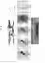 Fig. 15 - Multilayer armor