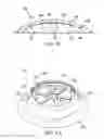 Fig. 10 - Impact indicator