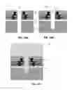 Fig. 10 - ACTIVE MICRO SIEVE AND METHODS FOR BIOLOGICAL APPLICATIONS